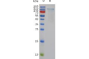 ADAMTS1 Protein (AA 50-967) (His tag)