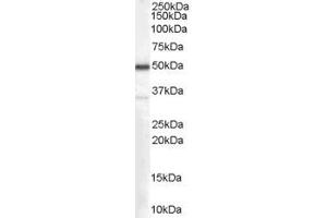 Western Blotting (WB) image for anti-Chromosome 4 Open Reading Frame 3 (C4ORF3) (Middle Region) antibody (ABIN2781849) (C4ORF3 antibody  (Middle Region))