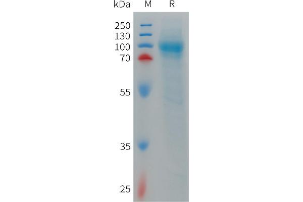 LRRN1 Protein (AA 26-630) (His tag)