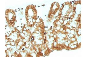 IHC testing of FFPE mouse colon tissue with EpCAM antibody. (EpCAM antibody  (Cytoplasmic Domain))