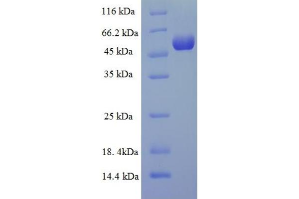 TPST2 Protein (AA 26-377) (His-SUMO Tag)