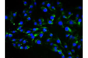 4 % Paraformaldehyde-fixed Human Umbilical Artery Endothelial Cells (HUAEC)probed with Anti-Vimentin Polyclonal Antibody, Alexa Fluor 488 conjugated (ABIN1695948) was used to stain the cell nuclei (Vimentin antibody  (AA 371-466))