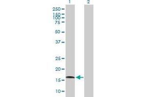 Lane 1: AGTRAP transfected lysate ( 16. (AGTRAP 293T Cell Transient Overexpression Lysate(Denatured))