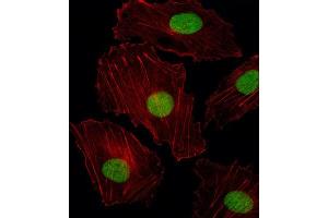 Immunofluorescence (IF) image for anti-ISL LIM Homeobox 2 (ISL2) antibody (ABIN2998805) (ISL2 antibody)