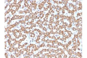 Formalin-fixed, paraffin-embedded human Liver stained with Prohibitin Mouse Monoclonal Antibody (PHB/3229). (Prohibitin antibody  (AA 167-261))