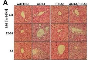 HBsAg expression elevates liver injury in Abcb4 knockout mice. (HBSAg antibody)