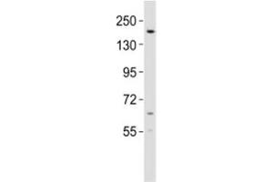 Western blot testing of KDM6B antibody at 1:2000 dilution + mouse lung lysate (Kdm6b antibody  (AA 879-912))
