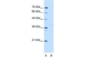 GMPPB antibody  (C-Term)