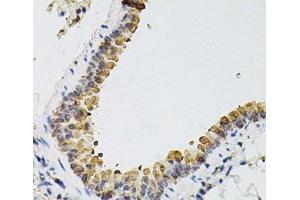 Immunohistochemistry of paraffin-embedded Mouse lung using ARHGEF2 Polyclonal Antibody at dilution of 1:100 (40x lens). (ARHGEF2 antibody)