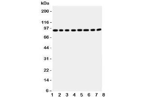 Western blot testing of Factor VIII antbody; Lane 1: A431;  2: HeLa;  3: SMMC-7721;  4: Jurkat;  5: Raji;  6: CEM;  7: HL-60;  8: MCF-7 cell lysate (Factor VIII antibody  (Middle Region))