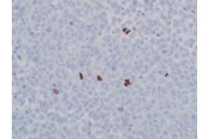 Image no. 1 for anti-Histone 3 (H3) (pSer10), (pSer28) antibody (ABIN952747) (Histone 3 antibody  (pSer10, pSer28))