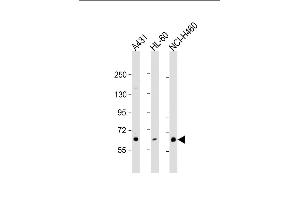 All lanes : Anti-PKC eta Antibody (N-term) at 1:1000 dilution Lane 1: A431 whole cell lysate Lane 2: HL-60 whole cell lysate Lane 3: NCI- whole cell lysate Lysates/proteins at 20 μg per lane. (PKC eta antibody  (N-Term))