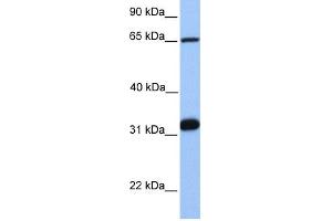 WB Suggested Anti-SF1 Antibody Titration:  0. (Splicing Factor 1 antibody  (C-Term))