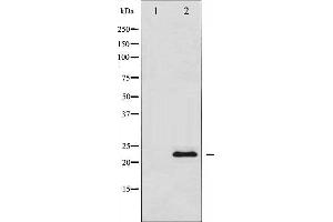 Western Blotting (WB) image for anti-TIMP Metallopeptidase Inhibitor 1 (TIMP1) antibody (ABIN1846495) (TIMP1 antibody)