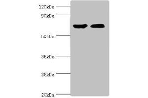 Western blot All lanes: CROT antibody at 3 μg/mL Lane 1: Mouse kidney tissue Lane 2: A431 whole cell lysate Secondary Goat polyclonal to rabbit IgG at 1/10000 dilution Predicted band size: 71, 11, 74 kDa Observed band size: 71 kDa (CROT antibody  (AA 1-87))