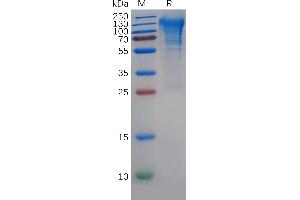 Human CD68 Protein, His Tag on SDS-PAGE under reducing condition. (CD68 Protein (AA 22-319) (His tag))