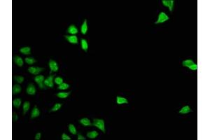 Immunofluorescence staining of Hela cells with ABIN7153030 at 1:133, counter-stained with DAPI. (FOXD3 antibody  (AA 1-140))