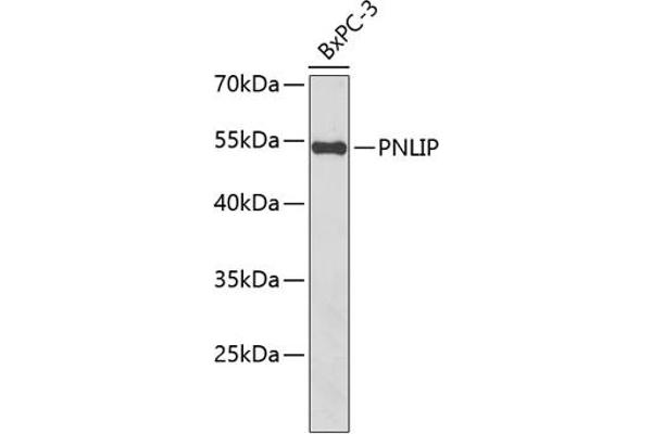 PNLIP antibody  (AA 166-465)