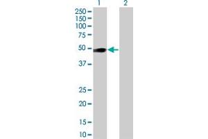 Lane 1: OSMR transfected lysate ( 39. (OSMR 293T Cell Transient Overexpression Lysate(Denatured))