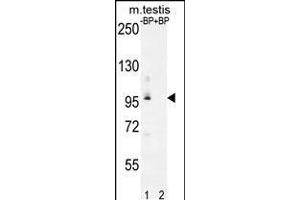 Western blot analysis of PDPR Antibody Pab pre-incubated without(lane 1) and with(lane 2) blocking peptide in mouse testis tissue lysate (PDP antibody  (C-Term))
