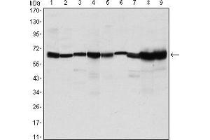 Western blot analysis using CARM1 mouse mAb against MCF-7 (1), Hela (2), NIH/3T3 (3), HL-60 (4), LNcap (5), Jurkat (6), PC-3 (7), Cos7 (8), and PC-12 (9) cell lysate. (CARM1 antibody)