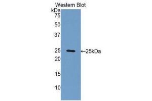 Western Blotting (WB) image for anti-Fibulin 2 (FBLN2) (AA 858-1069) antibody (ABIN1176012) (FBLN2 antibody  (AA 858-1069))