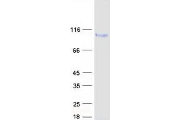 LRFN5 Protein (Myc-DYKDDDDK Tag)