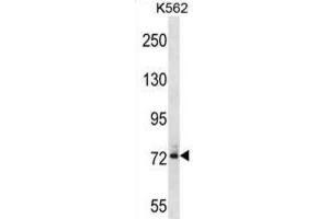 Western Blotting (WB) image for anti-Dynein, Axonemal, Intermediate Chain 1 (DNAI1) antibody (ABIN2998975) (DNAI1 antibody)