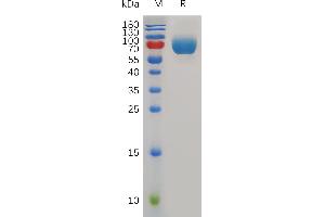 Mouse D Protein, hFc Tag on SDS-PAGE under reducing condition. (CD226 Protein (CD226) (AA 19-254) (Fc Tag))