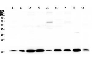 Western blot analysis of LIF using anti-LIF antibody . (LIF antibody  (AA 24-203))