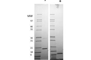 SDS-PAGE (SDS) image for Resistin Dimer protein (ABIN6700460)