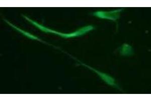 Immunofluorescence (IF) image for anti-Vimentin (VIM) (pSer33) antibody (ABIN1449152) (Vimentin antibody  (pSer33))