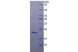 SDS-PAGE (SDS) image for Corticotropin Releasing Hormone (CRH) ELISA Kit (ABIN6574093)