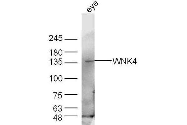 WNK4 antibody  (AA 351-450)