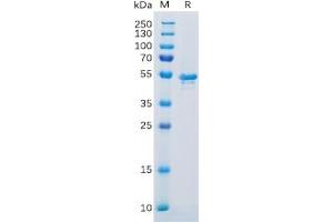 Human CA9 Protein, His Tag on SDS-PAGE under reducing condition. (CA9 Protein (AA 38-414) (His tag))