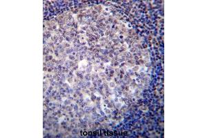 Immunohistochemistry (IHC) image for anti-Recombination Activating Gene 2 (RAG2) antibody (ABIN5978584) (RAG2 antibody)