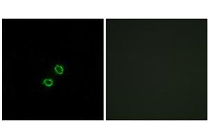 Immunofluorescence analysis of A549 cells, using KIR2DL5B antibody. (KIR2DL5B antibody  (Internal Region))