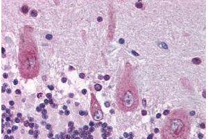 Human Brain, Cerebellum (formalin-fixed, paraffin-embedded) stained with KIF21A antibody ABIN214120 at 5 ug/ml followed by biotinylated goat anti-rabbit IgG secondary antibody ABIN481713, alkaline phosphatase-streptavidin and chromogen. (KIF21A antibody  (AA 551-600))