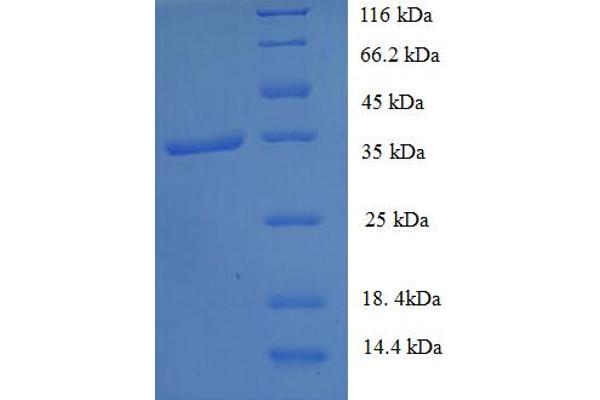 GTF2H5 Protein (AA 1-71, full length) (GST tag)