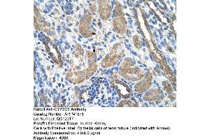 Rabbit Anti-CYP2D6 Antibody  Paraffin Embedded Tissue: Human Kidney Cellular Data: Epithelial cells of renal tubule Antibody Concentration: 4. (CYP2D6 antibody  (N-Term))