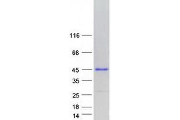 ENDOU Protein (Transcript Variant 3) (Myc-DYKDDDDK Tag)