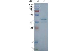 Human ST-Nanodisc, Flag Tag on SDS-PAGE (STING1 Protein)