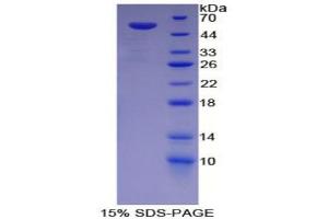 SDS-PAGE analysis of Rat G6PD Protein. (Glucose-6-Phosphate Dehydrogenase Protein (G6PD))