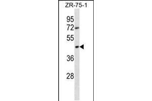Western blot analysis in ZR-75-1 cell line lysates (35ug/lane). (OR2T6 antibody  (C-Term))