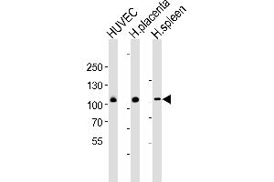 Western blot analysis of lysates from HUVEC cell line , huamn placenta and spleen tissue lysate(from left to right), using GP1BA(Glycocalicin) Antibody (Center) (ABIN6242723 and ABIN6577497). (CD42b antibody  (AA 344-378))