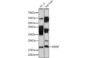 Western blot analysis of extracts of various cell lines, using BDNF Rabbit mAb (ABIN7265916) at 1:1000 dilution. (BDNF antibody)