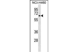 Western blot analysis in NCI-H460 cell line lysates (35ug/lane). (DCT antibody  (AA 286-314))