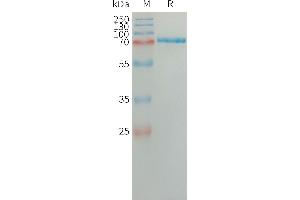 Human SA Protein, His Tag on SDS-PAGE under reducing condition. (SEMA7A Protein (AA 45-647) (His tag))