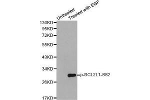 Western blot analysis of extracts from Hela cells using Phospho-BCL2L1-S62 antibody. (BCL2L1 antibody  (pSer62))
