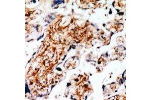 Immunohistochemical analysis of RLK staining in human placenta formalin fixed paraffin embedded tissue section. (TXK antibody)